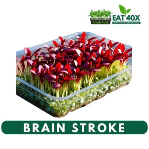 Brain Stroke